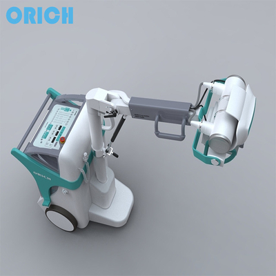 Orthopedic Fluoroscopy Machine High Quality Mobile X-Ray Which Don't Need X-ray Room
